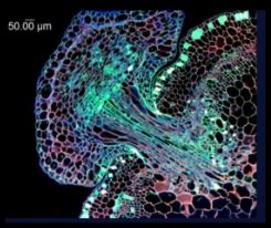 Laser DEW MicroExplosions in Your Brain