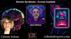 Havana Syndrome with Jessee Beltran